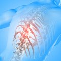 Bone Health