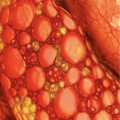 Vascular Health