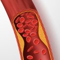 Cholesterol Health