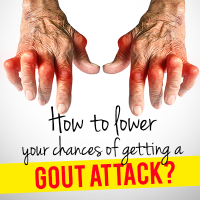 How to lower your chances of getting a gout attack? How to lower your chances of getting a gout attack?