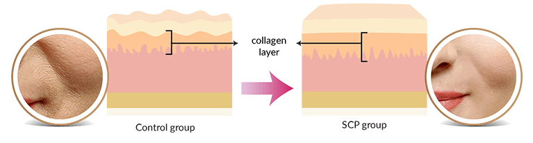 SCP thickens collagen layer of skin after 6 weeks