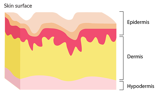 Skin diagram
