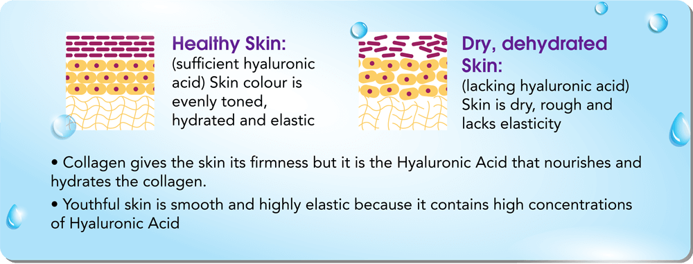 hyaluronic acid