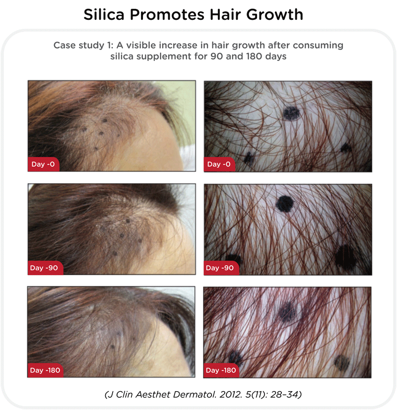 Silica for Hair Growth Key to Healthier Hair  Health Reporter